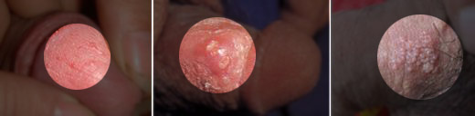 ������ֳ������֢״