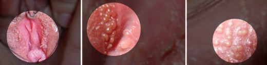 Ů�Լ���ʪ��֢״