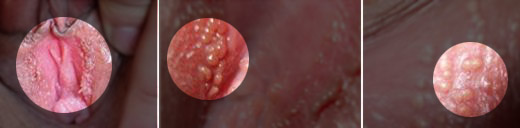 Ů�Լ���ʪ��֢״