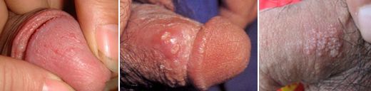 ������ֳ������֢״